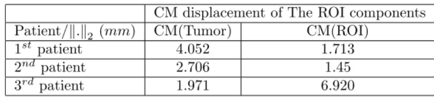 Table 4. The displacement of Center of Mass (CM) for the tumor and the global ROI (Edema+Tumor) CM displacement of The ROI components