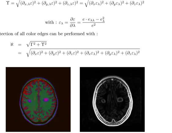 Figure 3. Left : Color MRI - Right : Spetral gradient.