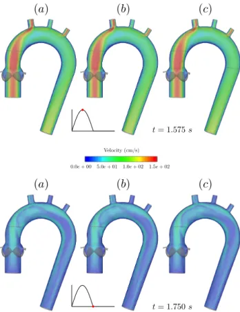 Figure 14: Static pressure formulation. Snapshot of the velocity magnitude at two time instants obtained with Algorithm 4.2 in two non-overlapping sub-domains (a), with inverted sub-problems (b) and in three non-overlapping sub-domains (c).