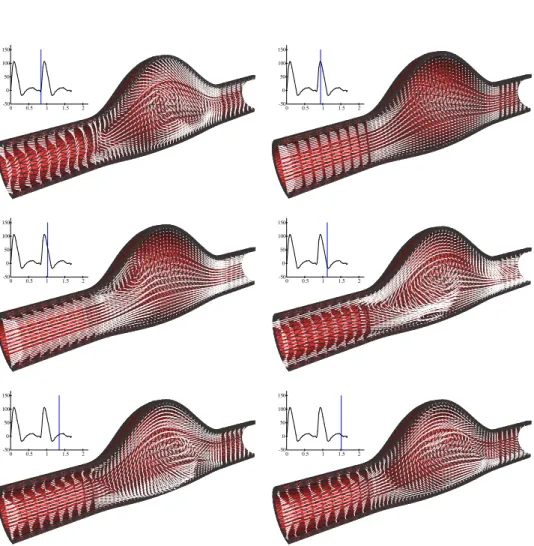 Figure 7: Robin based semi-implicit coupling: snapshots of the solid deformation and fluid velocity field at different time instants.