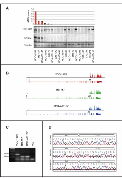 Figure 1. ATRA sensitivity and N1ICD expression in TNBC cell lines. (A) Upper: TNBC cell lines are  ranked in descending order according to the ATRA-score shown by the bar graph