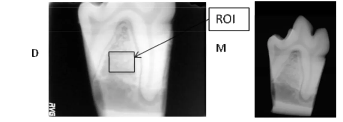 Figure 1: Digital dental radiograph Kodak  Figure 2 : D3A medical system radiograph  2.2 Micro Computed-Tomography   