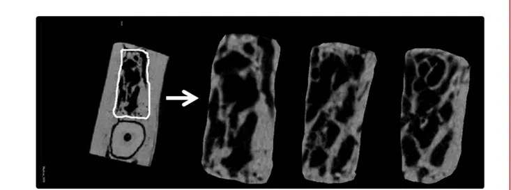 Figure 5 Individualized section of trabecular bone on several slices (human drawing and interpolation) 