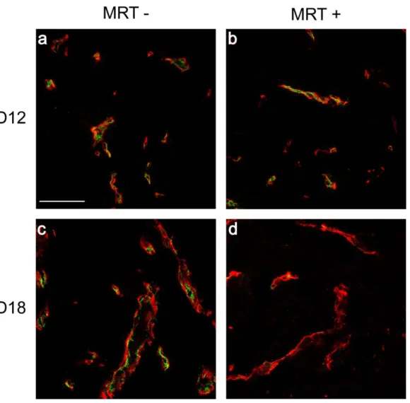 Figure  5:  Confocal  images  of  unirradiated  and  MRT-irradiated  9LGS  tumoral  blood  vessels