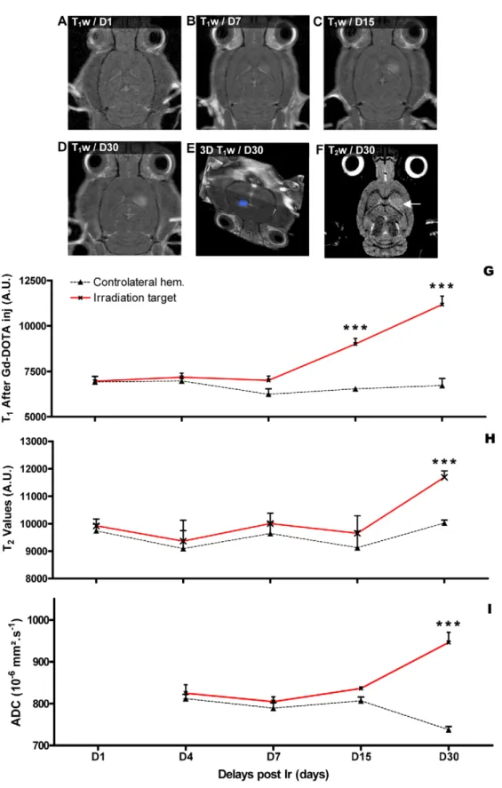 Figure 2. Temporal MRI follow up of the radiation target. A-D- MR characterization (T 1 -weighted images 5 min after Gd-DOTA injection) of the evolution of the radio-induced lesion between D1 and D30 after exposure