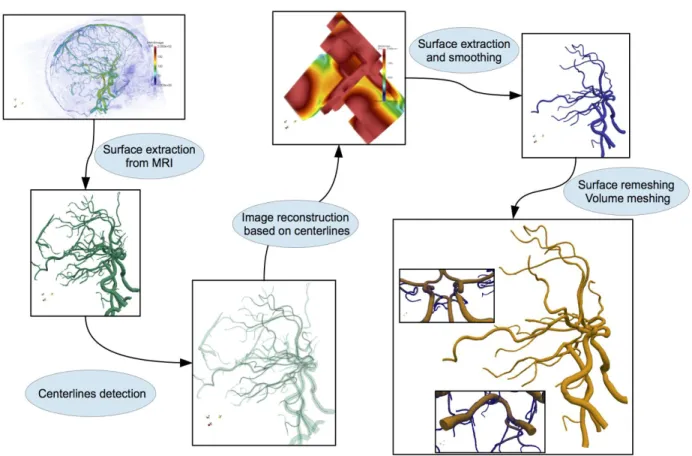 Figure 1: ​ from medical images (top left) to computational mesh (bottom right) 