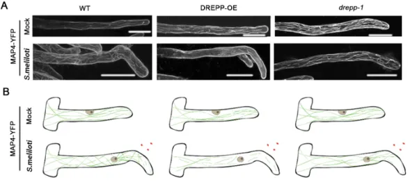 Fig. 5. Recruitment of DREPP to nanodomains coincides with microtubule fragmentation. (A) M