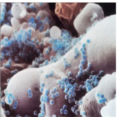 Figure  7  Surface  d’un  lymphocyte  T  infecté  par  le  Virus  de  l’Immunodéficience  Humaine  (d’après  [182] ) 