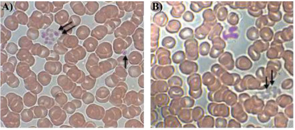 Figure 9 : Images de plaquettes témoin et de GPS. A) Frottis de sang total témoin : un amas de  plaquettes  normales  est  indiqué  par  les  flèches