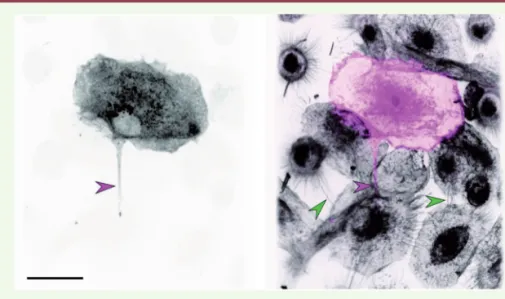 Figure 2. Le VIH-1 emprunte les nanotubes. Des macrophages humains sont traités par le CmMTB  et infectés par le VIH-1, puis fixés et marqués
