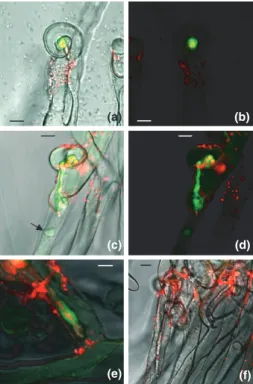 Fig. 1 Detection of nitric oxide (NO) during infection threads growth by confocal laser scanning microscopy