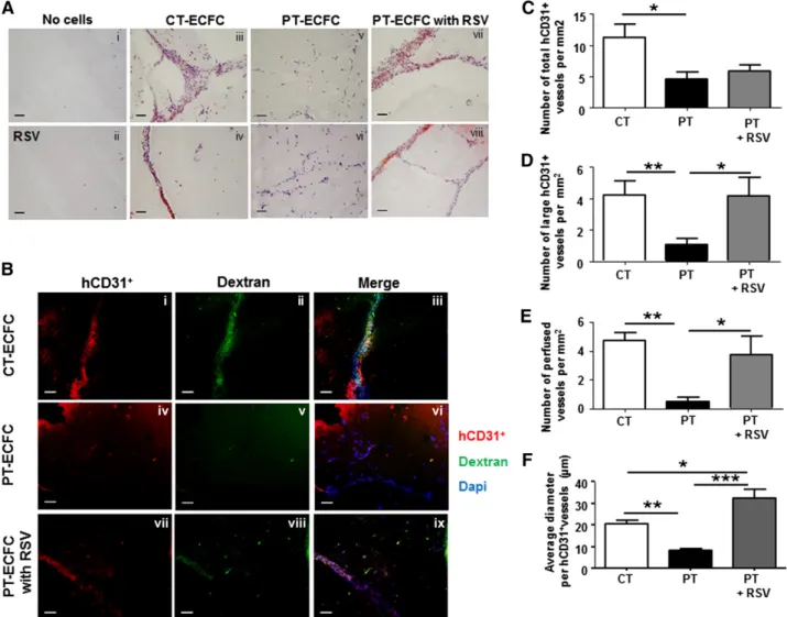 Figure 7. RSV stimulates capacities of PT-ECFCs to form functional blood vessels in vivo