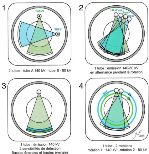 Figure 2 : Les quatre solutions technologiques permettant l’accès au mode bi-énergie 