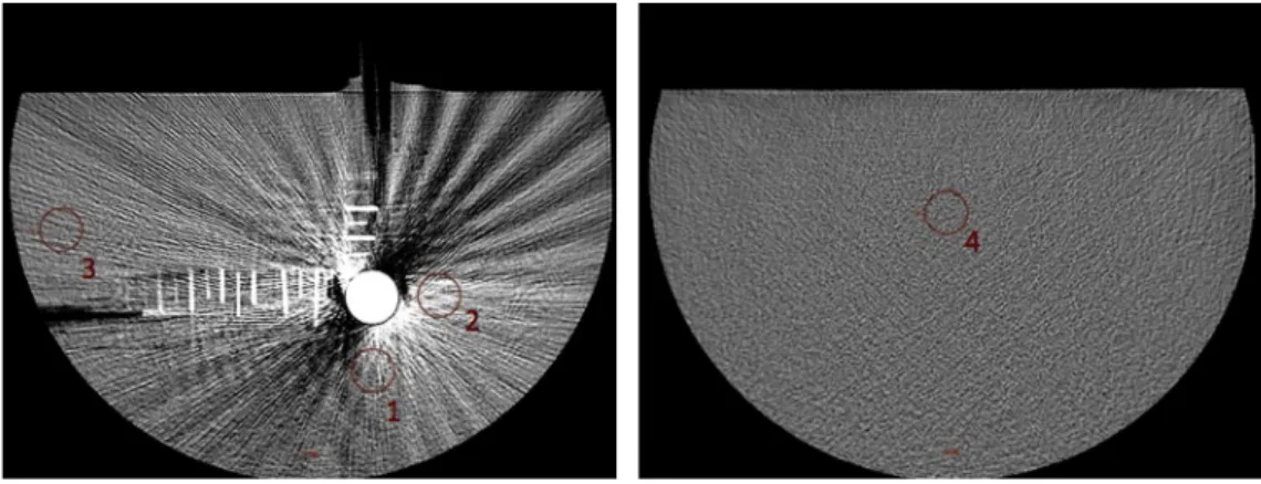 Figure 13 : Placement des ROI sur les images 