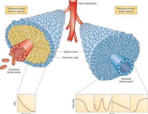 Figure 18: Illustration de l’hypoxie aigue et chronique, au sein d’une masse tumorale proliférant autour d’un  vaisseau sanguin (156) 