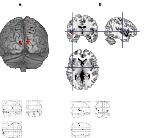 Figure 2. Divergence (sources) of the gradient vectors for face and word processing. (A) Sources for face processing in the occipital cortex.