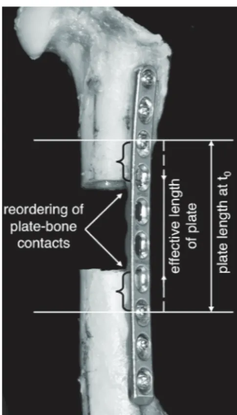 Figure 8  Photograph  showing  reordering  of  plate-bone  contacts  with  changes  in  effective  plate  length