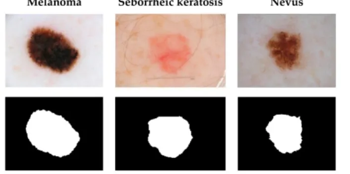 Fig. 1. Samples from the ISIC dataset. In the first row, the original images;