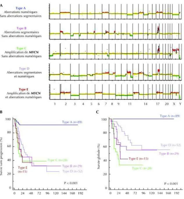Figure 10 : Les différents profils génomiques tumoraux de neuroblastome déterminés en CGH-array  sur 493 échantillons tumoraux de neuroblastome (A) et leur impact sur la survie sans évènement (B)  et su  la su ie glo ale  C   d’ap s Ja ouei -Lerosey et al.