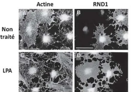 Figure 8 : Effet de la surexpression de RND1 sur la formation des fibres de stress d’actine