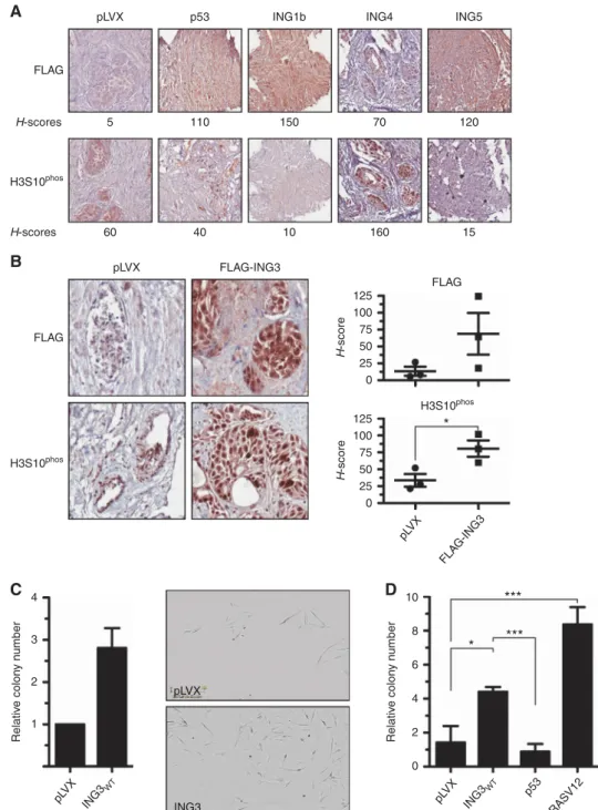 Figure 1. Ex vivo screen and transformation assays. (A) Ex vivo patient BPH tissues were transduced with negative control vector pLVX, positive control FLAG-p53, or FLAG-INGs