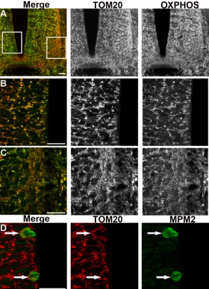 Fig 3. Immunodetection of the outer mitochondrial membranes TOM20 reveals the same changes in mitochondrial morphology than OXPHOS