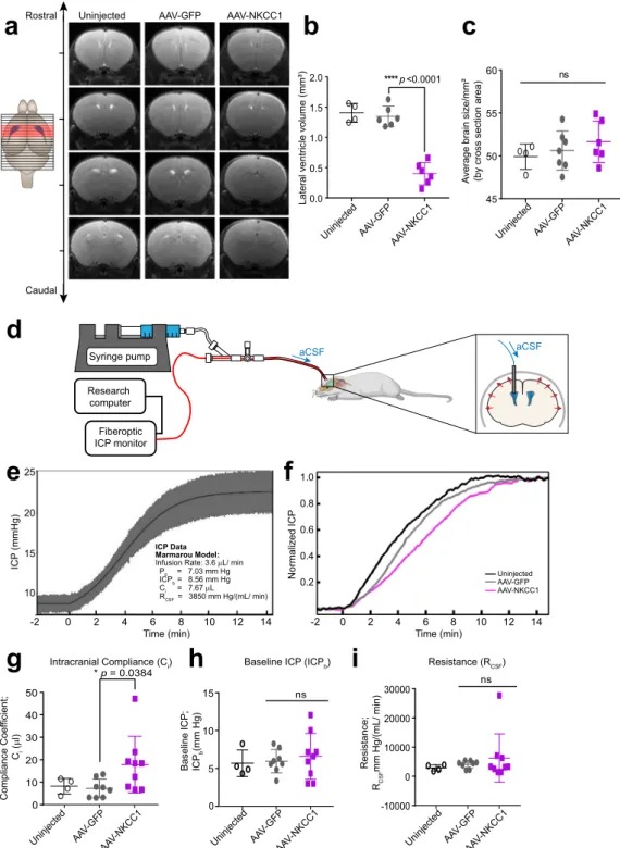 Fig. 5 ChP NKCC1 overexpression reduces brain ventricular volume and increases intracranial compliance