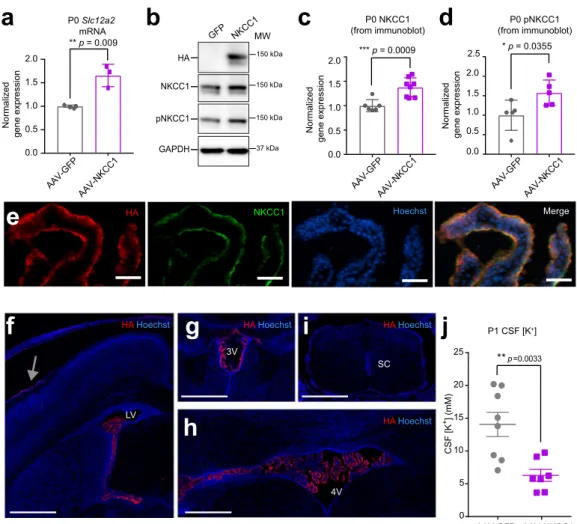 Fig. 4 ChP NKCC1 actively mediates CSF K + clearance during the ﬁ rst postnatal week. a RT-qPCR of NKCC1 mRNA levels in P0 mice