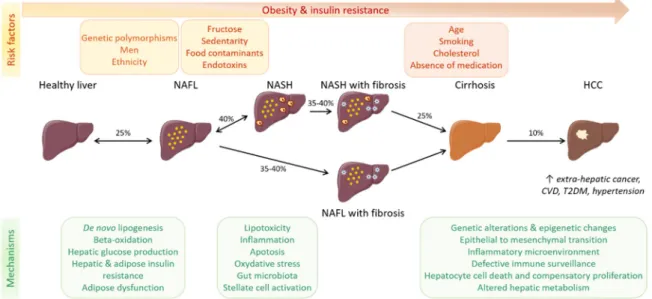Figure 2. NAFLD progression. NAFLD is a progressive disease characterized by fat accumulation in  hepatocytes, ranging from hepatic steatosis (NAFL) to non-alcoholic steatohepatitis (NASH), with  additional inflammation with or without fibrosis