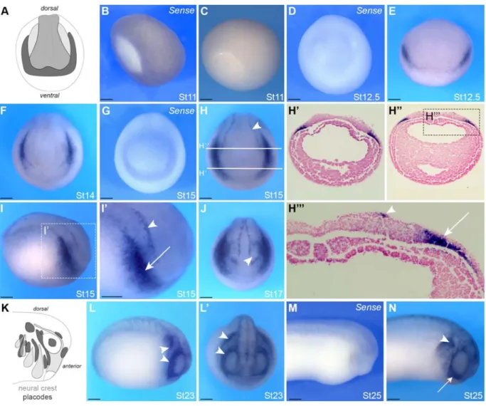 Figure 2: Developmental expression of MMP28 by in situ hybridization. 