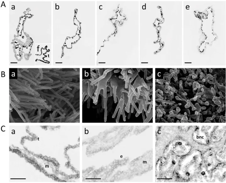 Figure 3. New biological outcomes of validated DEGs. A) FN1 is restricted to the endoderm