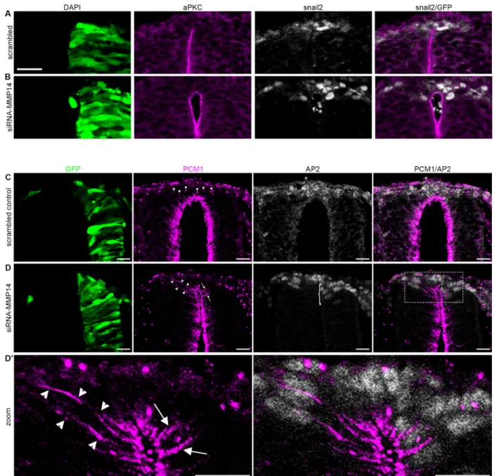 Fig. 3. MMP14 inhibition prevents the apicobasal redistribution of PCM1 during NC EMT