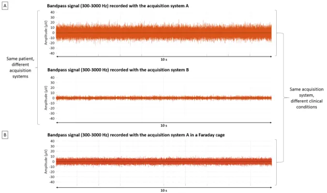 Figure 6 – Comparison of different acquisition systems and clinical conditions. A) Filtered 