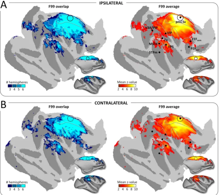 Figure 5. Functional connectivity: group results. Whole-brain pmCSv resting-state functional connectivity