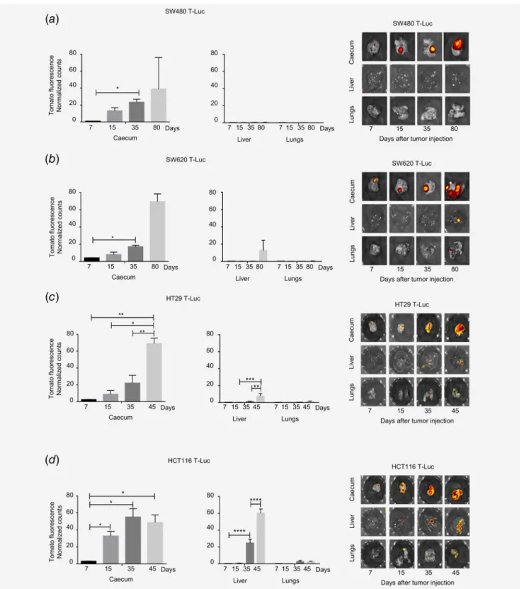 Figure 3 . Different metastatic potential of the four human colon carcinoma cell lines implanted in SCID beige mice