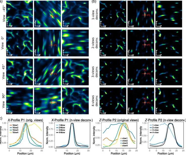 Fig. 3 Improvement of the vascular network imaging isotropy from using multiview deconvolution.