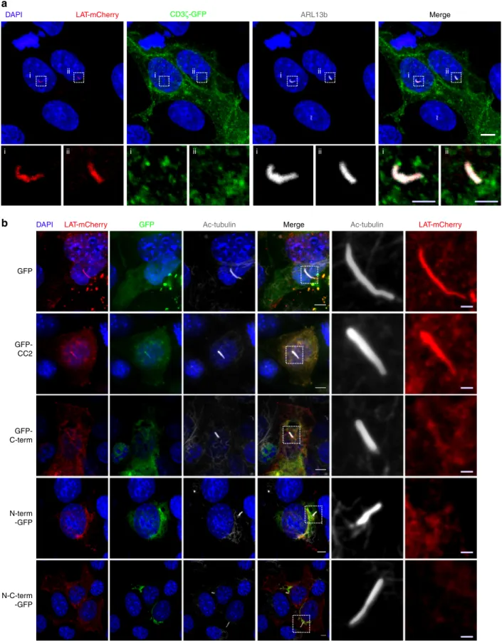 Fig. 8 Speci ﬁ c recruitment of LAT to the primary cilium depends on GMAP210 tethering activity