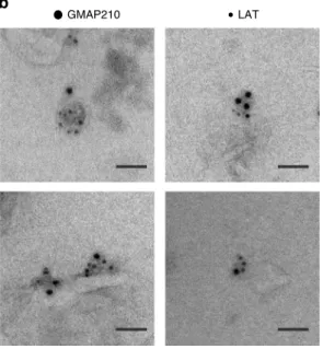 Fig. 1 GMAP210 is present in membranes puri ﬁ ed from T lymphocytes and containing LAT