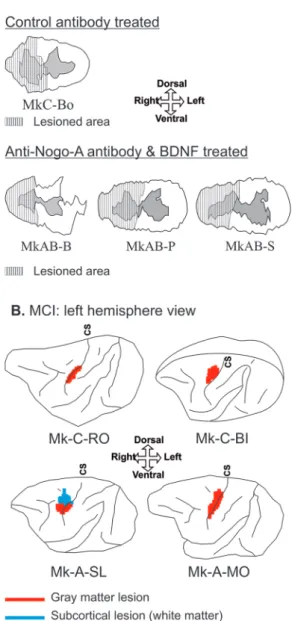 Figure 2.  Representation of the spinal cord and motor cortical injury. For  each monkey injected with CB, reconstruction of the spinal cord injury (SCI)  on a transverse section at C7-C8 level (panel A) and the unilateral motor  cortex injury (MCI) on a s