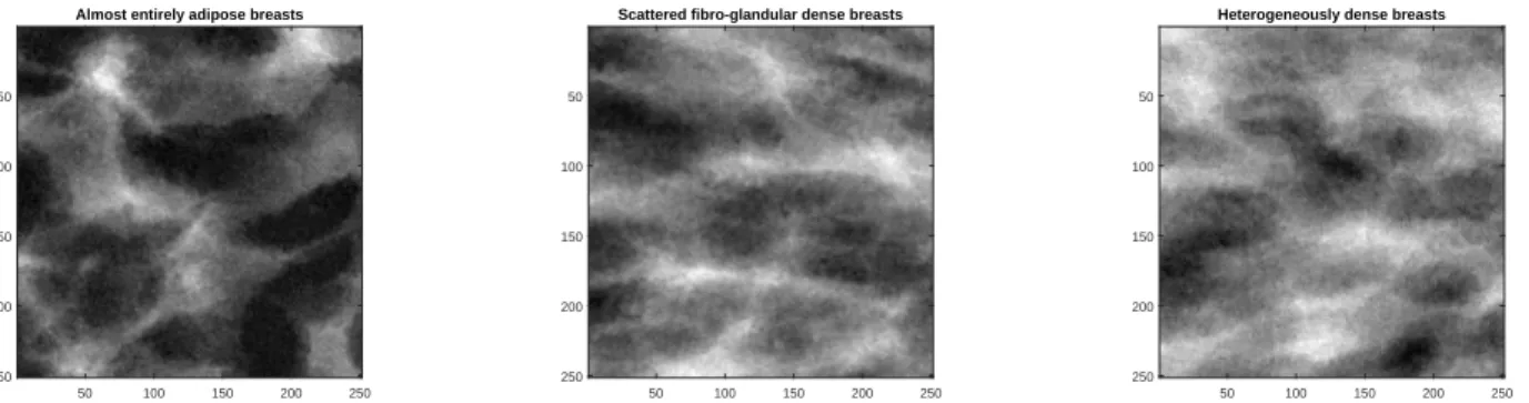 Figure 2: Synthetic digital mammograms study. Image 1.F from group (F) (left), 1.FG from group (FG) (center) and 1.D from group (D) (right)
