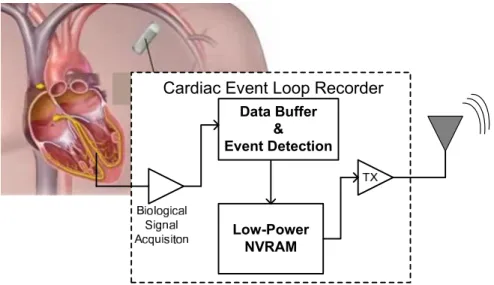 Figure 1.3: Example Application: Cardiac Loop Recorder Block Diagram