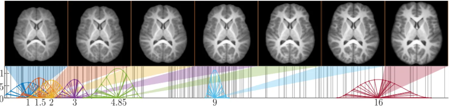 Fig. 2. Longitudinal atlas (top) and associated weight functions (bottom) for ages: 1, 1.5, 2, 3, 4.85, 9 and 16 years