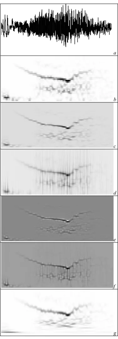 Figure a shows this selected segment from ictal phase of one  seizure. This segment contains a particular pattern, a  parabolic signature, in the time-frequency plane