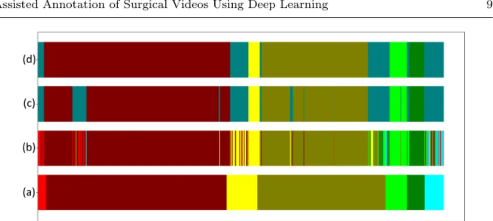 Fig. 3 Frame-by-frame results for video A, each color corresponds to a phase label, the detected errors are in gray