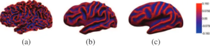 Fig. 2. Original cortical mesh is iteratively ﬂattened to a PFS. From left to right 0,20,50, 75 and 100 iterations