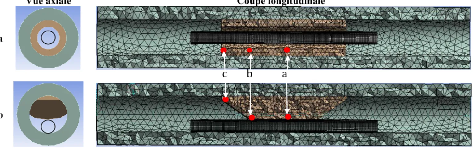 Figure 1 – Modèle éléments finis pour simuler le traitement par ATP seule dans le cas d’une plaque d’athérome  a) axisymmétrique ou b) non-axisymmétrique