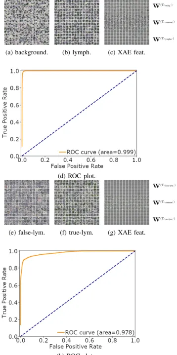 Fig. 1: The corresponding images of lymphocyte detec- detec-tion/classification and the corresponding ROC plots: (a)-(d) lymphocyte detection; (e)-(h) lymphocyte classification.