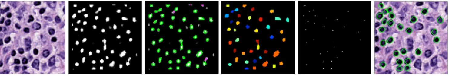 Fig. 2: The procedure of lymphocyte segmentation: (a) the input; (b) a probability map obtained from the proposed lymphocyte detection based on XAE+FCN, where the intensity represents the probability that a pixel belongs to a lymphocyte; (c) performing gen
