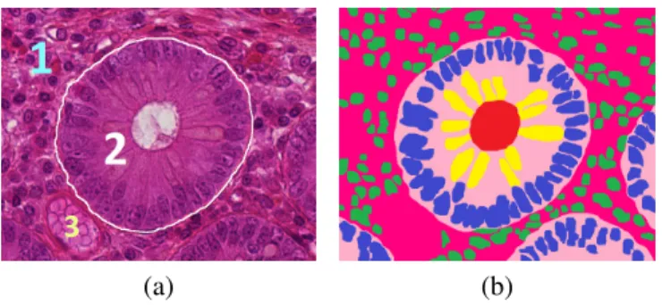 Figure 1: (a.1) connective tissue, (a.2) crypt and (a.3) blood vessel. (b) Red: lumen