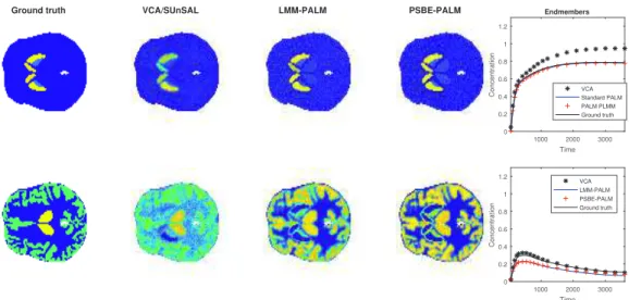 Fig. 2. Abundance maps (left) and corresponding TACs (right) associated with the SBR (top) and gray matter (bottom).